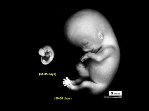 Week 8 Embryo